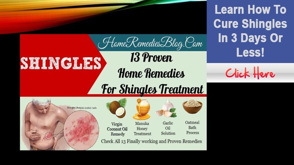 Learn how to cure shingles in 3 days with proven remedies, quick treatments, and expert tips. Find fast relief and reduce symptoms effectively. Click here!