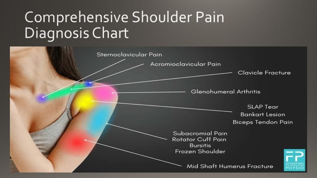 Shoulder pain diagnosis chart showing different pain locations and potential causes, including rotator cuff injuries, arthritis, bursitis, and tendonitis.